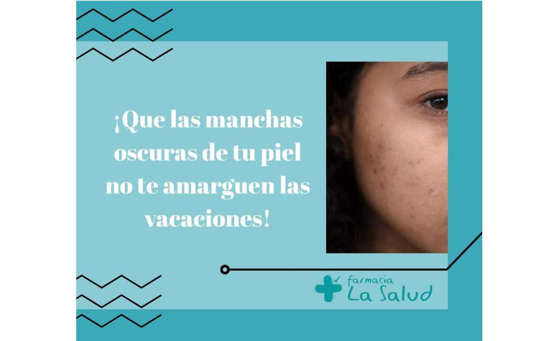 ¡Que las manchas oscuras de tu piel no te amarguen las vacaciones!